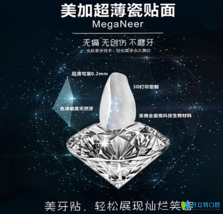 <!--<i data=20240703-sp></i>-->兵解析美加超薄牙貼面使用壽命 <!--<i data=20240703-sp></i>-->兵解析美加超薄牙貼面使用壽命