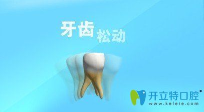 牙齒松了可以固定嗎,那些問牙齒松了怎么拔的人怎么想的？