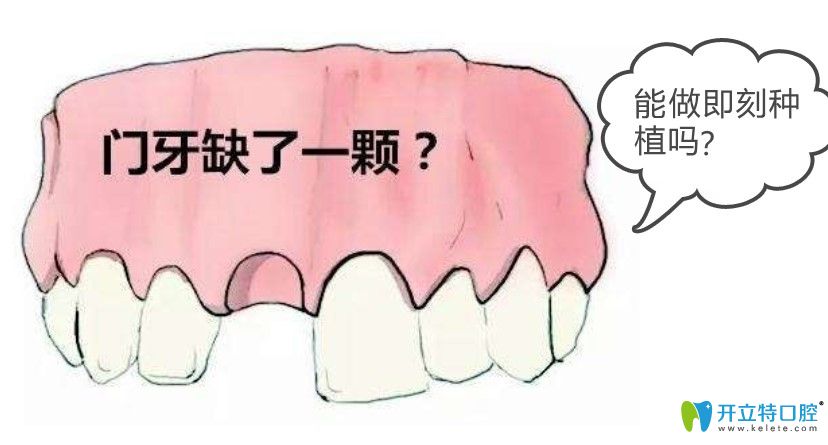門牙缺失能做即刻種植牙嗎