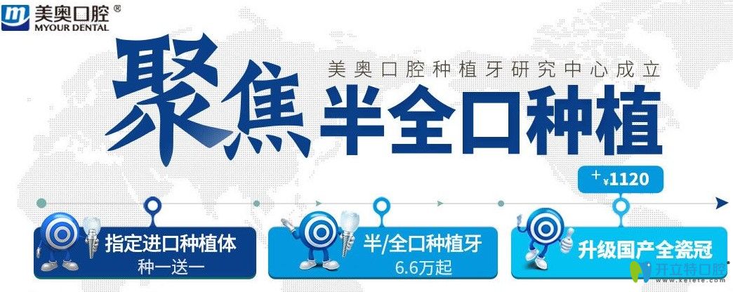 超劃算！杭州美奧口腔美國皓圣和法國安卓健都是種1送1吶