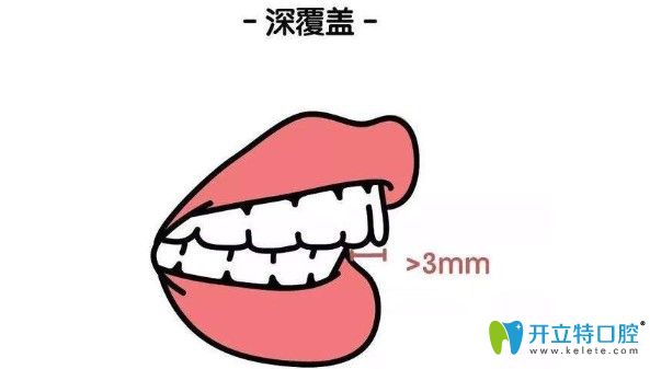 深覆蓋何不趁著康美做活動(dòng)矯正走起來(lái)