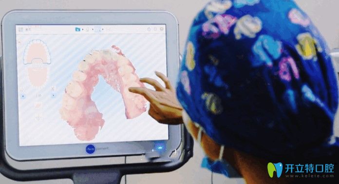 北京維樂(lè)口腔iTero口掃作用