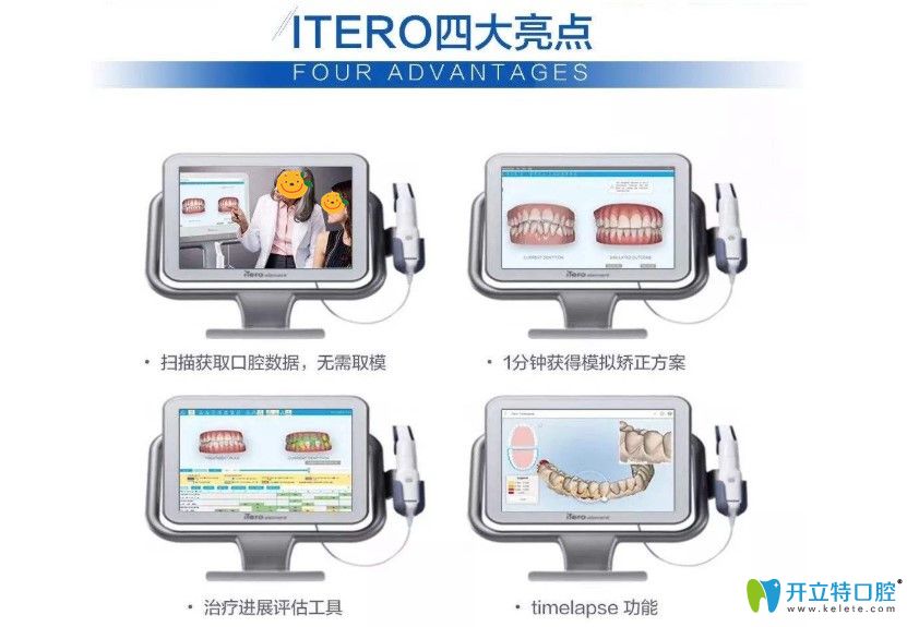 在維樂(lè)口腔可以免費(fèi)體驗(yàn)iTero口掃
