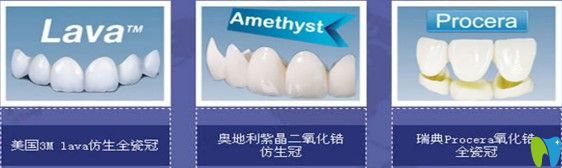 不同烤瓷牙的對(duì)比圖 不同烤瓷牙的對(duì)比圖