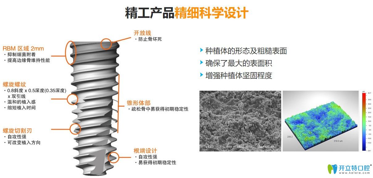 億美佳口腔韓國奧齒泰體優(yōu)勢多多