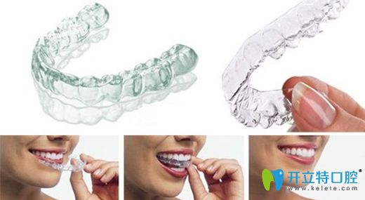 陶泉欣醫(yī)生對(duì)隱形正畸有著深入的研究 陶泉欣醫(yī)生對(duì)隱形正畸有著深入的研究