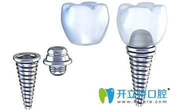 雅定和奧齒泰哪個好