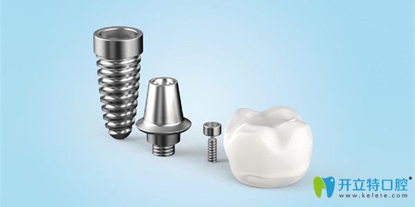 維樂種植牙甄選高端種植體