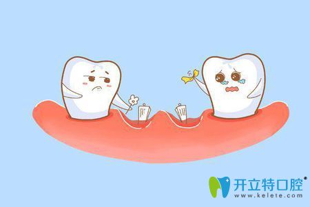 缺牙怎么辦 缺牙怎么辦