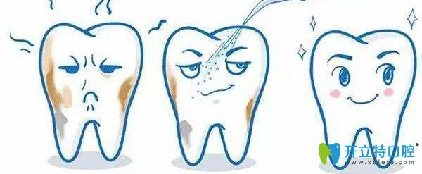 泰州北極星牙齒洗白后的圖片 泰州北極星牙齒洗白后的圖片