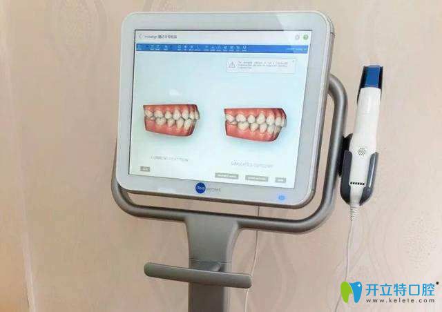 隱形喬正黑科技iTero