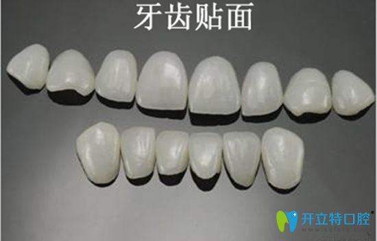 做超薄瓷貼面后悔是有原因的,說(shuō)下我做牙齒貼面5年后的感受