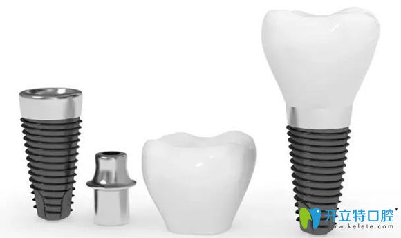 意大利西泰克種植系統(tǒng)