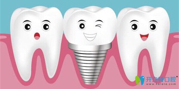 種植牙和真牙的比較