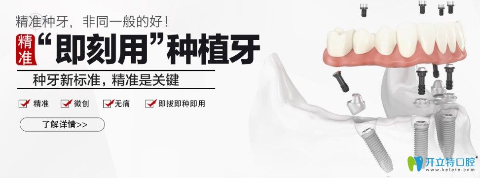廣州廣大口腔精準(zhǔn)即刻用種植牙優(yōu)勢