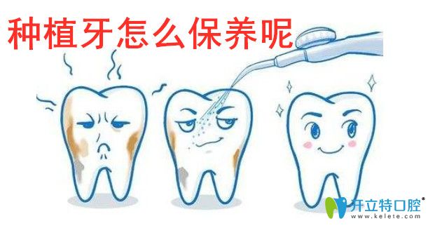 種植牙怎么保養(yǎng)才會(huì)使用更久