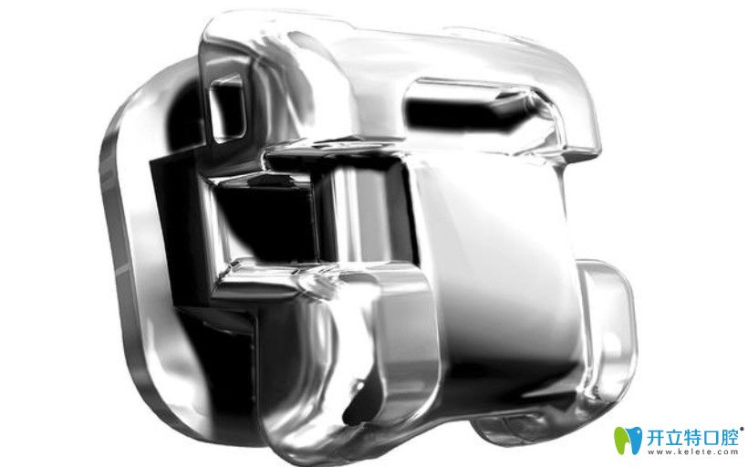 美國ormco自鎖托槽矯正優(yōu)勢(shì)