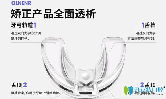 德國clnenr可林爾隱形牙套示意圖