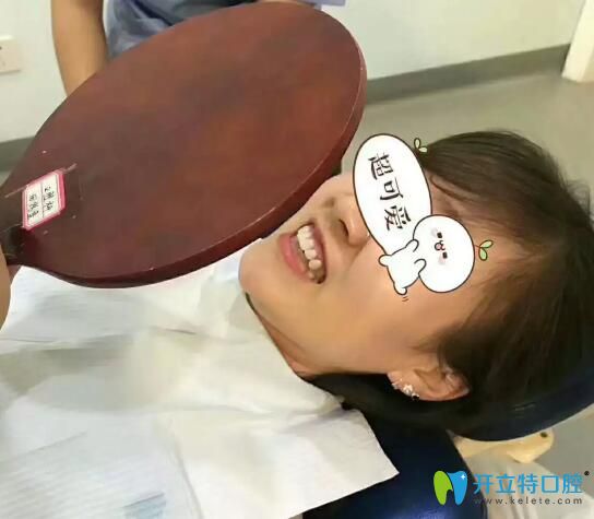 佛山壹加壹口腔醫(yī)院牙齒貼面真人案例 佛山壹加壹口腔醫(yī)院牙齒貼面真人案例