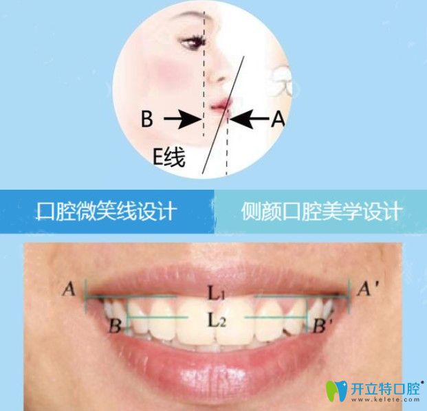 廣州美萊在正畸方面有獨(dú)到的美學(xué)標(biāo)準(zhǔn)