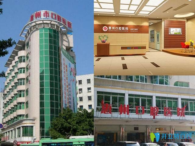 惠州口腔醫(yī)院排名出爐,匯總惠城/惠陽區(qū)技術(shù)好又便宜的牙科