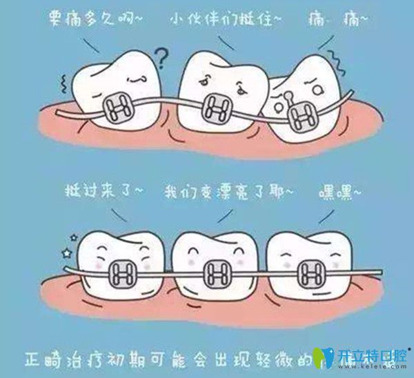 正畸的價(jià)格是多少