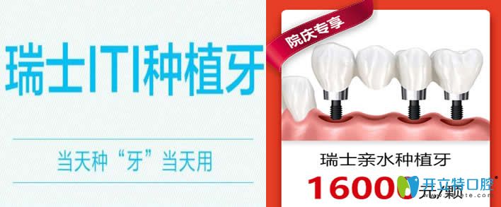 廣州廣大口腔瑞士ITI種植牙優(yōu)惠價格