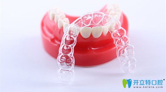 隱形矯正器怎么樣 隱形矯正器怎么樣