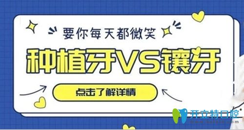 高昂醫(yī)生講解種植牙和鑲牙的優(yōu)點和缺點 高昂醫(yī)生講解種植牙和鑲牙的優(yōu)點和缺點