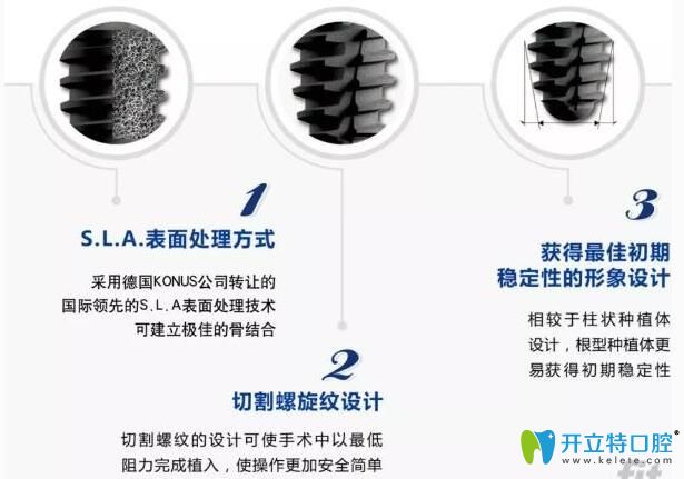 從仕諾康種植體的特性看看好不好