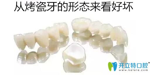 從烤瓷牙的形態(tài)來看好壞