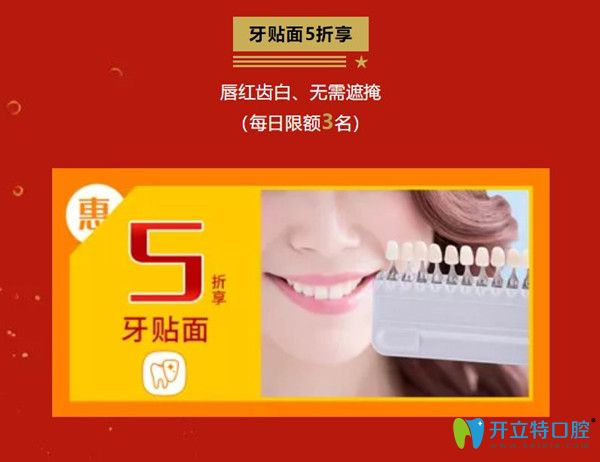 國(guó)慶柏德口腔牙齒貼面5折優(yōu)惠