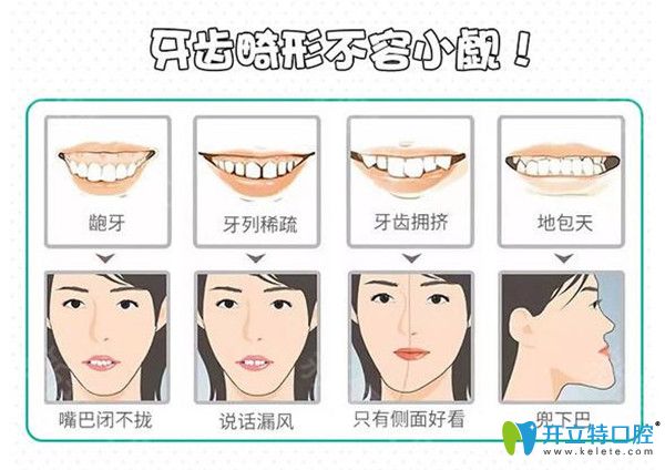 牙友自身看牙經(jīng)歷評測深圳友誠齒科正畸價(jià)格及效果怎么樣