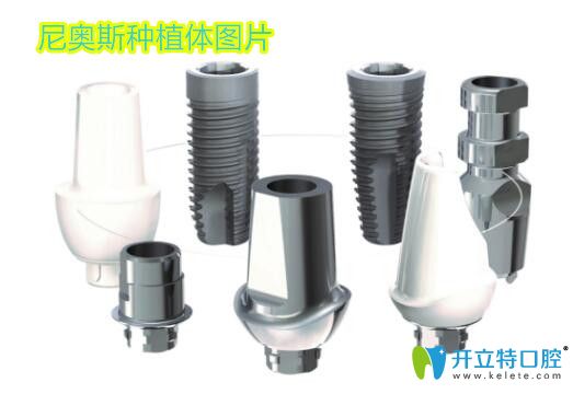 問瑞典英國尼奧斯/neoss種植體怎么樣?多少錢的人,先搞清這個(gè)