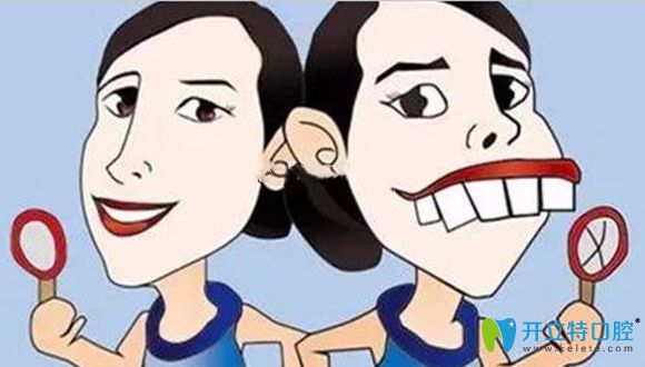 齙牙做牙齒矯形的前后效果對(duì)比