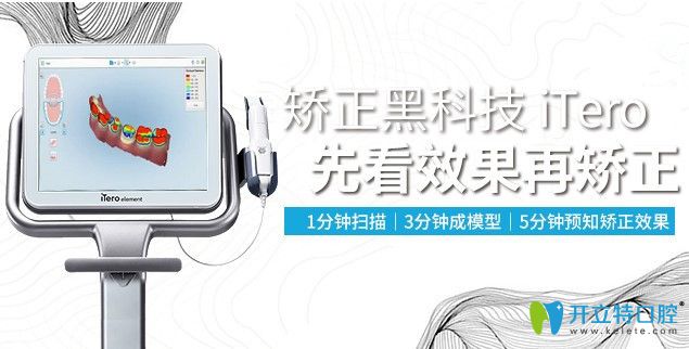 維樂口腔itero口內(nèi)掃描儀