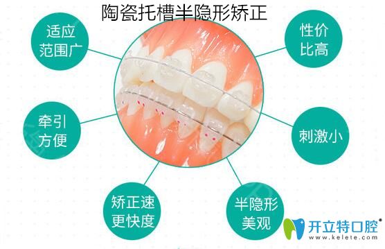 陶瓷托槽半隱形矯正圖