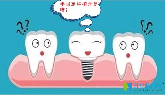 修復(fù)缺牙是選半口半固定種植牙還是固定種植好呢,區(qū)別在哪