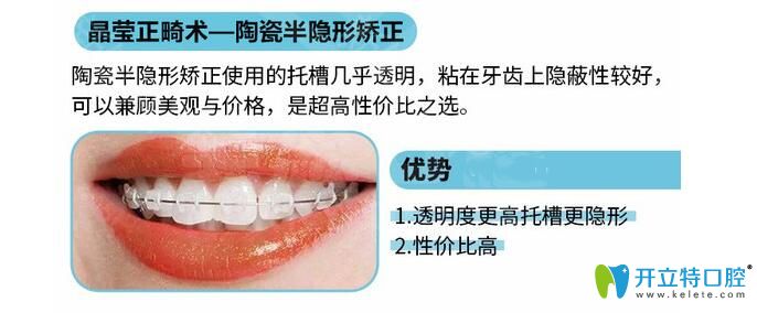 陶瓷托槽半隱形矯正優(yōu)勢(shì)