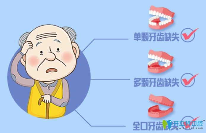 即刻種植牙價(jià)格表