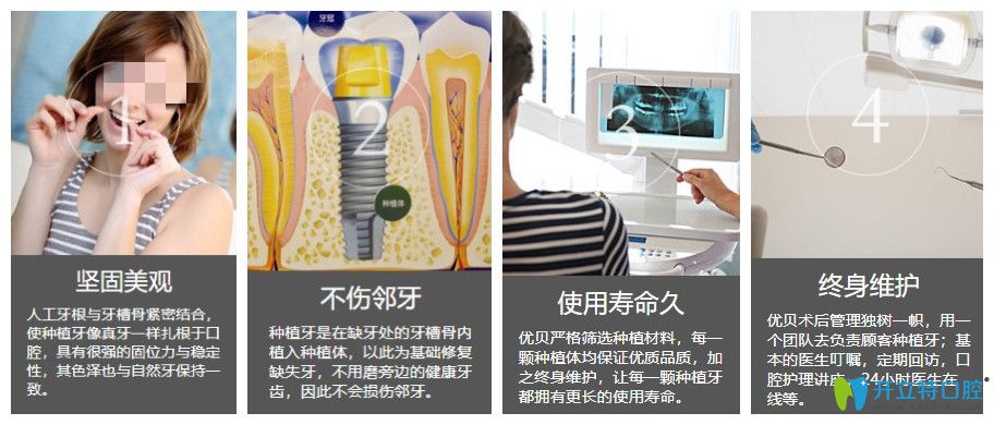 優(yōu)貝口腔種植牙的4大優(yōu)勢
