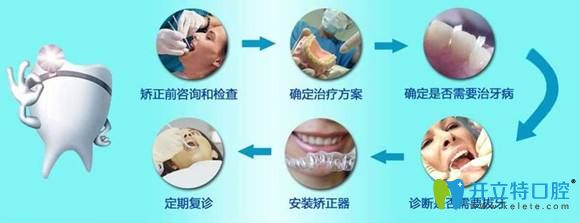 牙齒矯正過程