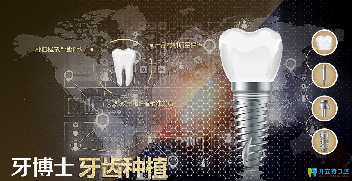 在牙博士口腔種牙還有很多優(yōu)勢(shì)哦