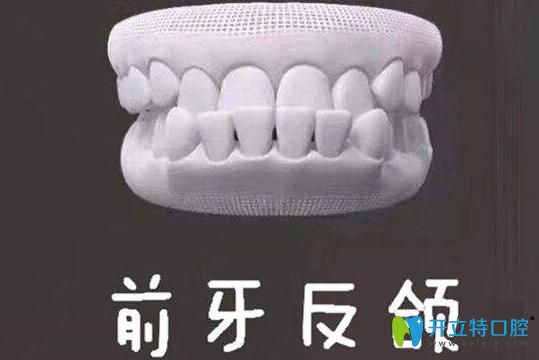 牙齒地包天能自我矯正嗎？牙齒反頜的矯正方法了解一下吧