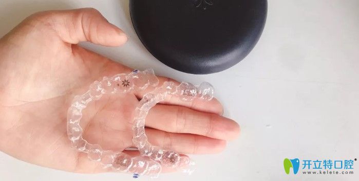 帶隱適美牙套1—12個(gè)月的感受
