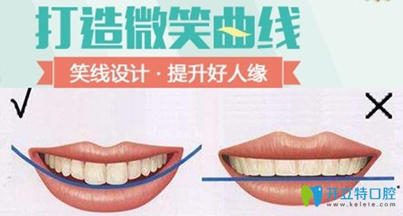 醫(yī)美醫(yī)院牙齒矯正中的微笑曲線設(shè)計(jì)效果圖