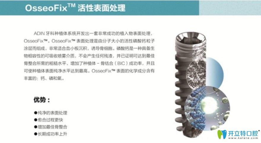 雅定（ADIN）采用OsseoFixTM的表面處理