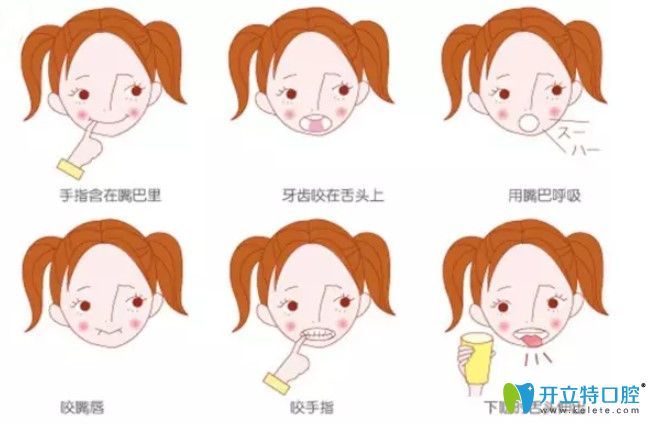 咬合誘導(dǎo)技術(shù)都有哪些？兒童咬合誘導(dǎo)有啥副作用？