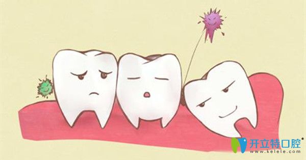 空間不足容易引發(fā)冠周炎