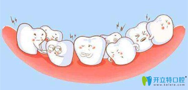 牙齒擁擠要及時(shí)做矯正